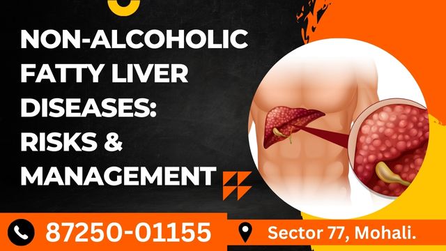 http://blog.sghshospitals.com/uploads/Non-alcoholic fatty liver diseases Risks and management